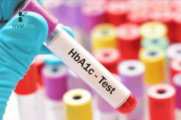 Chỉ số HbA1c (Hemoglobin A1c)
