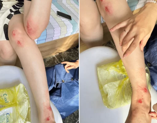 vết trầy xước xe