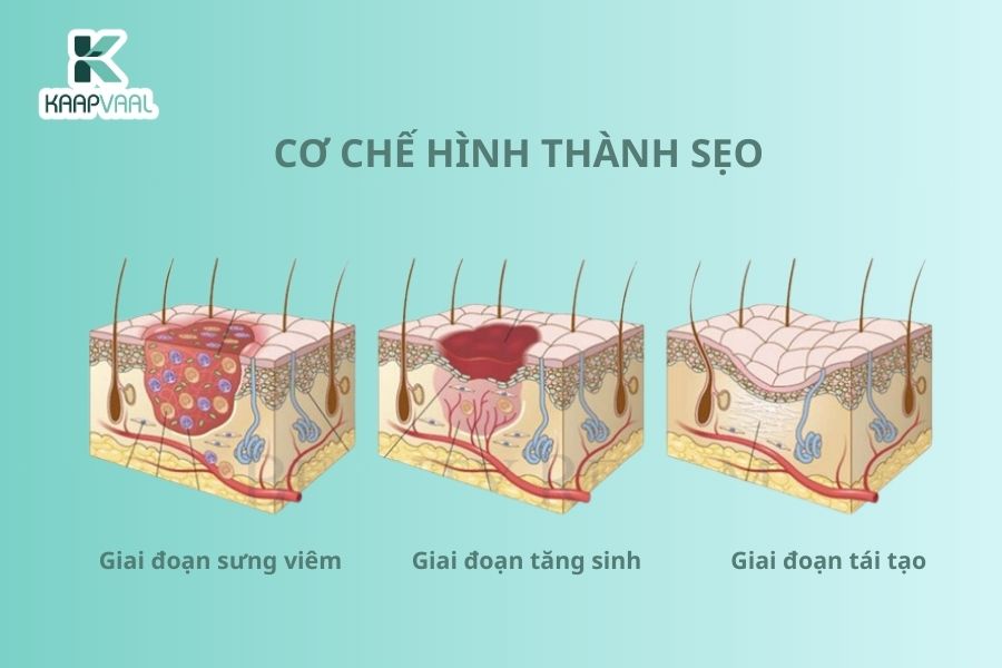 Kaapvaal - Thuốc trị sẹo hàng đầu ứng dụng Công nghệ Y học tái tạo
