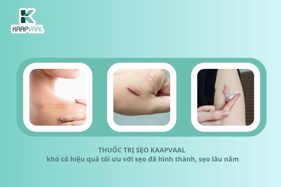 Kaapvaal - Thuốc trị sẹo hàng đầu ứng dụng Công nghệ Y học tái tạo