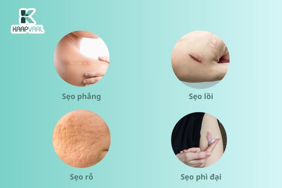 Kaapvaal - Thuốc trị sẹo hàng đầu ứng dụng Công nghệ Y học tái tạo