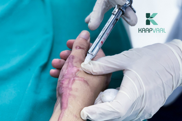 Phương pháp tiêm trị sẹo lồi