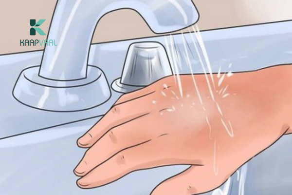 Làm mát vùng bị bỏng