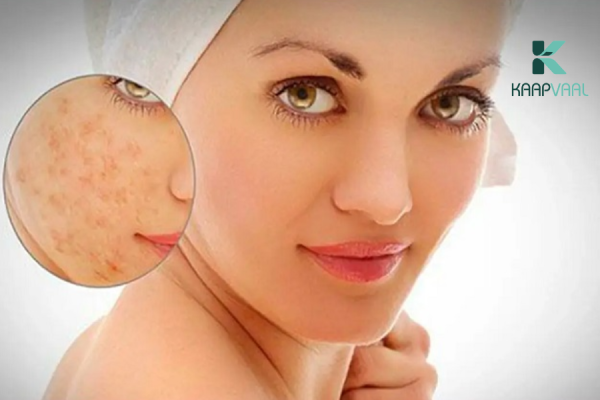 Ưu điểm và nhược điểm của phương pháp cắt đáy sẹo