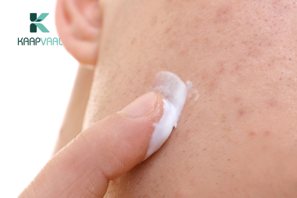 Lưu ý khi sử dụng kem trị sẹo